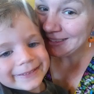 Write 31 Days – Day 23 (My Legs are Itching!!)